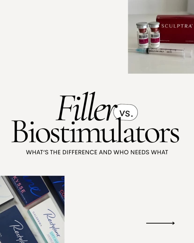 Injector template — filler vs. biostimulators